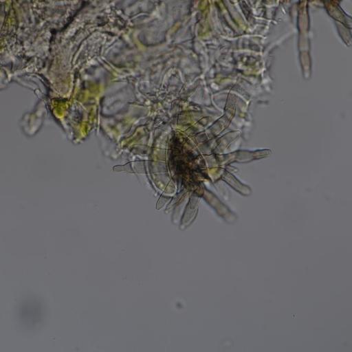 Pseudocercospora