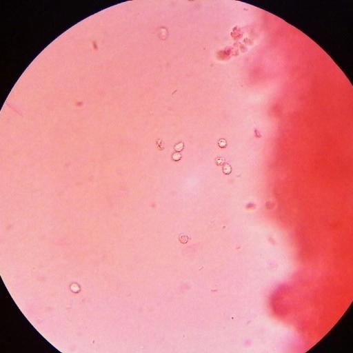 Trechispora Mollusca Mushroom Identification Habitat Uses Trechispora Mollusca Mushroom Identification Habitat Uses