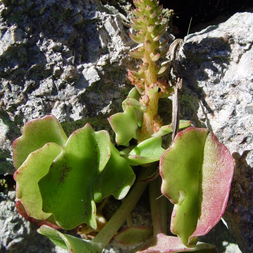 Umbilicus Horizontalis